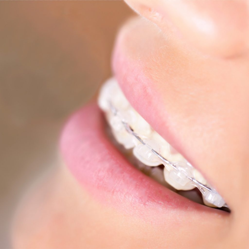 Ortodonzia a Verona | Studio dentistico a Verona | Studio dentistico Muraro