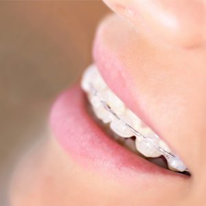 Ortodonzia a Verona | Studio dentistico a Verona | Studio dentistico Muraro