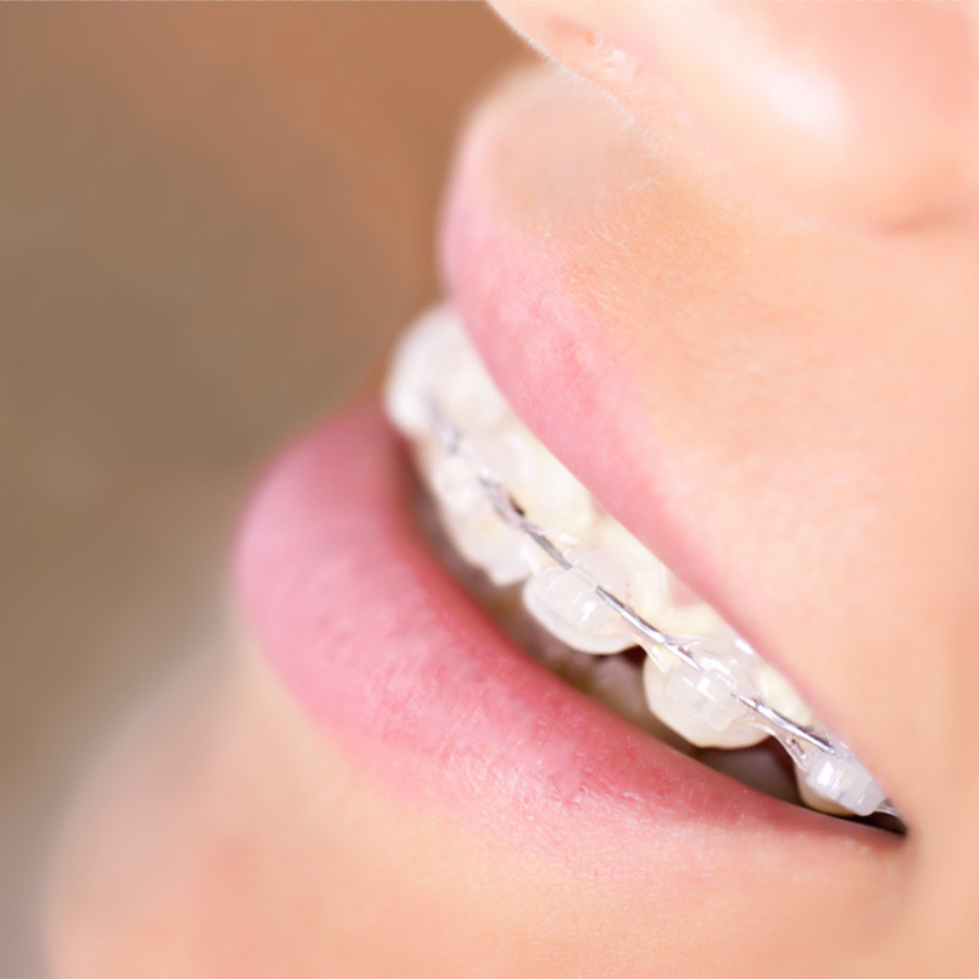 Ortodonzia a Verona | Studio dentistico a Verona | Studio dentistico Muraro