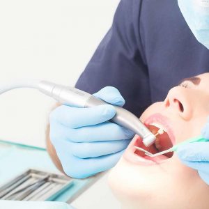 Conservativa a Verona | estetica-dentale a Verona | Studio dentistico a Verona | Studio dentistico Muraro