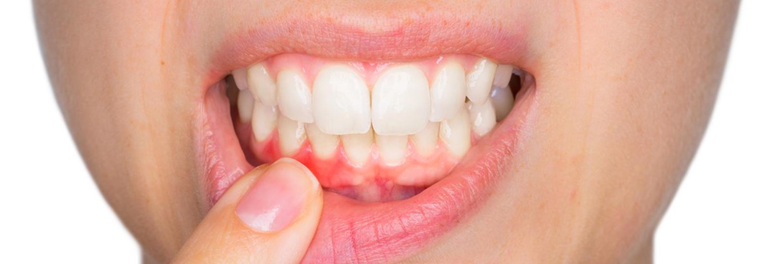 Parodontologia a Verona | Studio dentistico a Verona | Studio dentistico Muraro I Parodontologia a Verona | Studio dentistico a Verona | Studio dentistico Muraro I