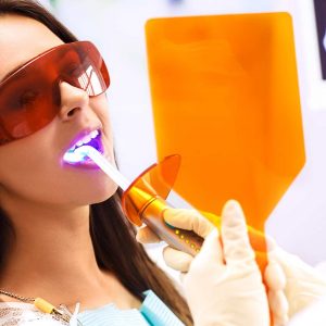 Sbiancamento dentale a Verona | Studio dentistico a Verona | Studio dentistico Muraro