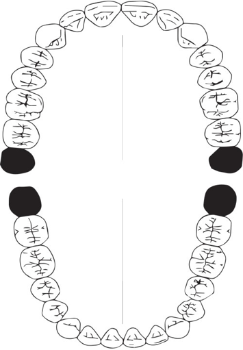 Bocca - Dentista a Verona - Studio Associato Muraro