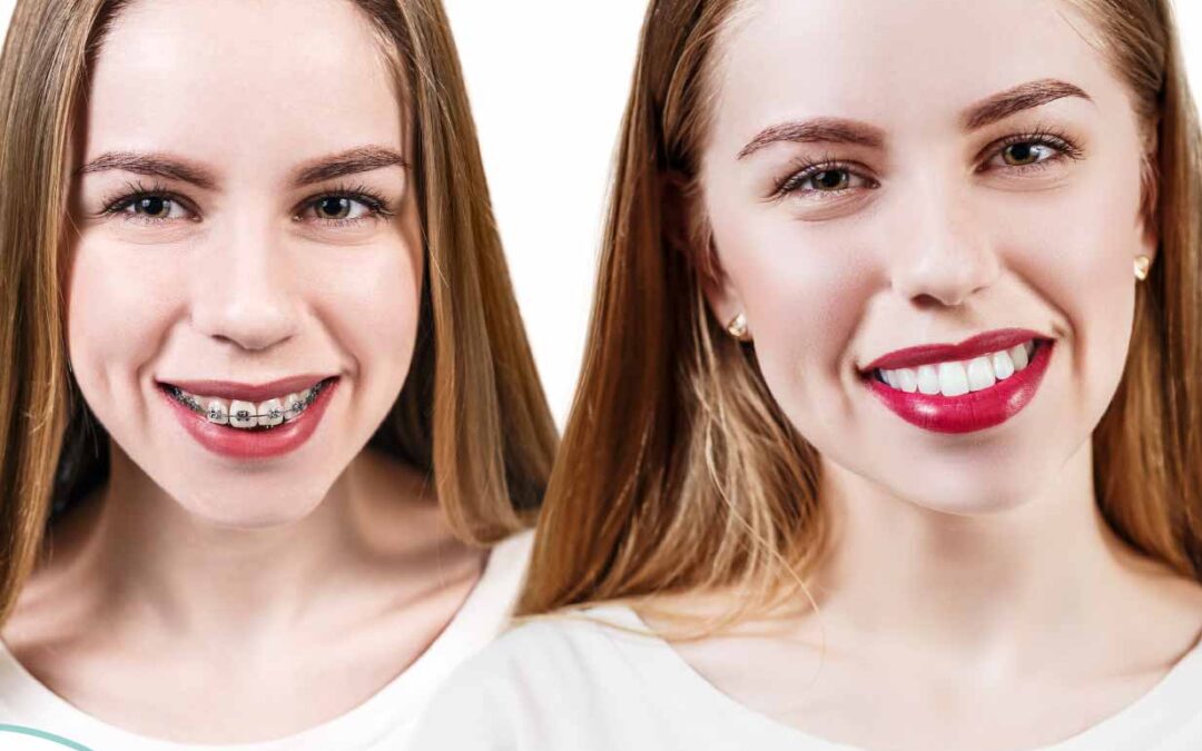 Non si vede, non si tocca e non si sente: è l’apparecchio trasparente!